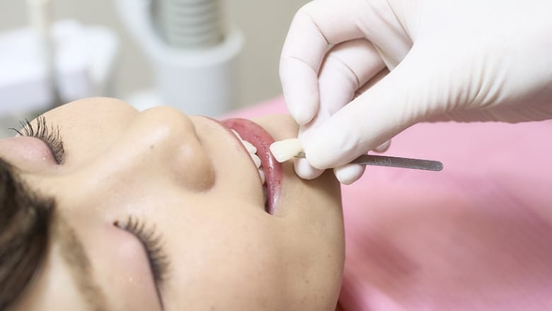 銀歯から白い歯へ